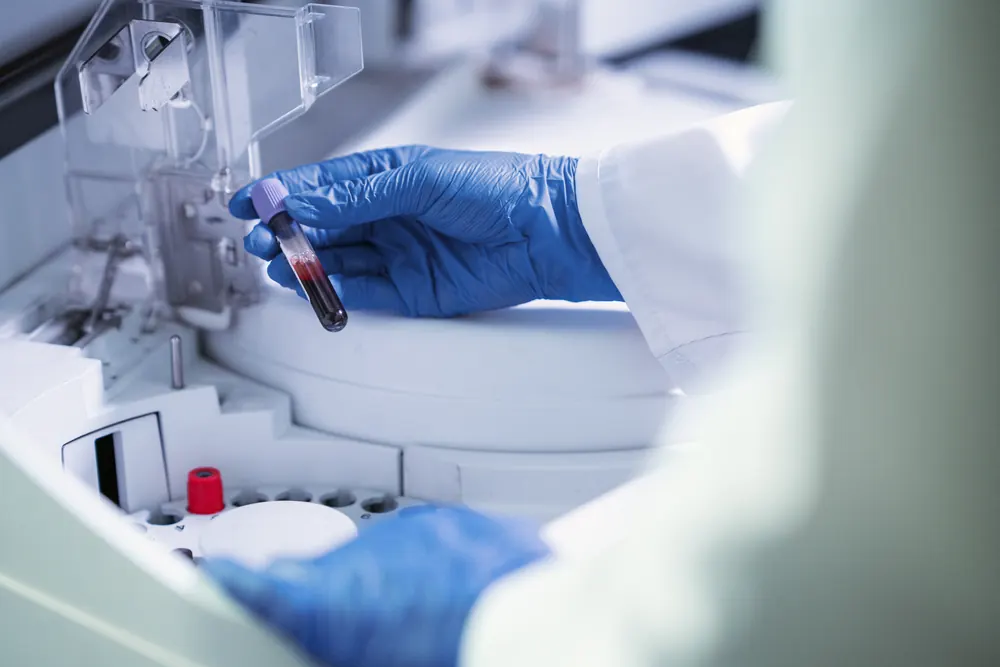 Profissional de laboratório de luvas azuis manuseando amostras. Imagem ilustrativa.