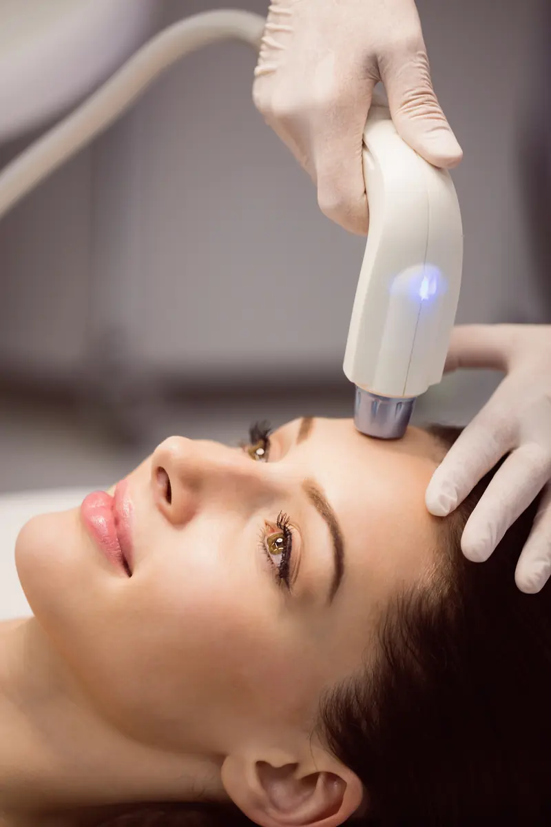 Mulher recebendo aplicação de laser no rosto.